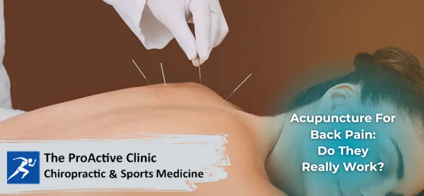 Acupuncture For Back Pain: Do They Really Work?
